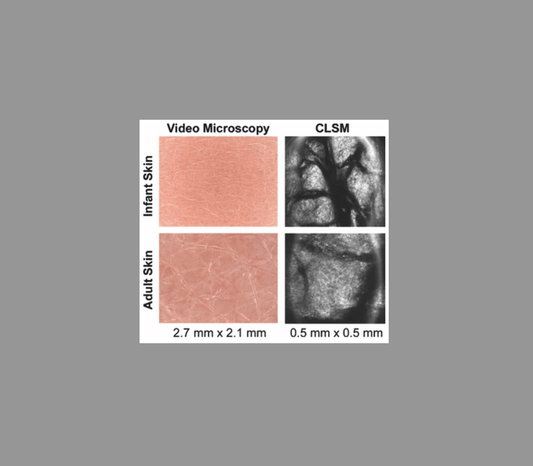 Étude sur les caractéristiques de la peau de bébé